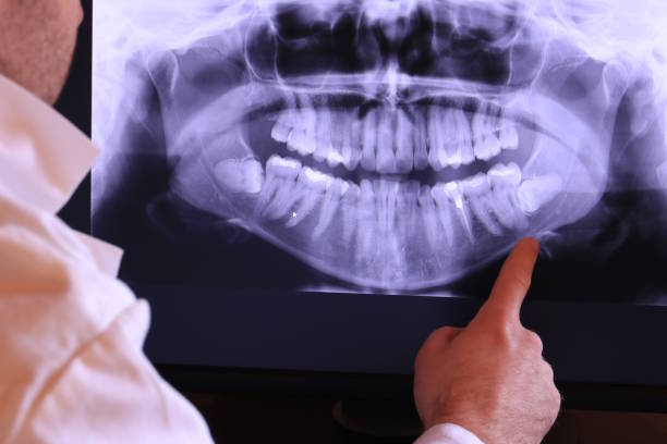 Best Emergency Dentist for Knocked-Out Tooth in Timonium, MD