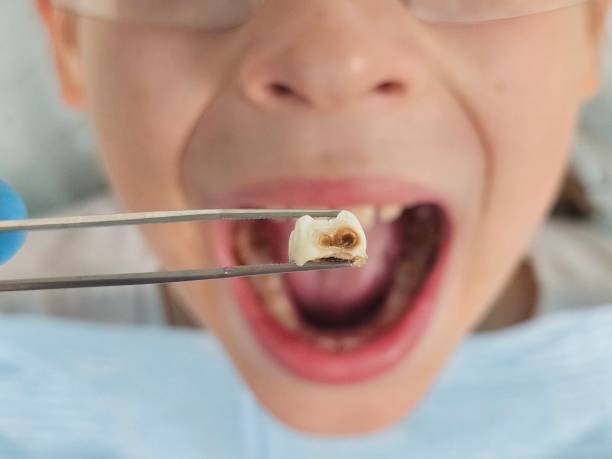 Best Emergency Dental Services for Seniors in Timonium, MD